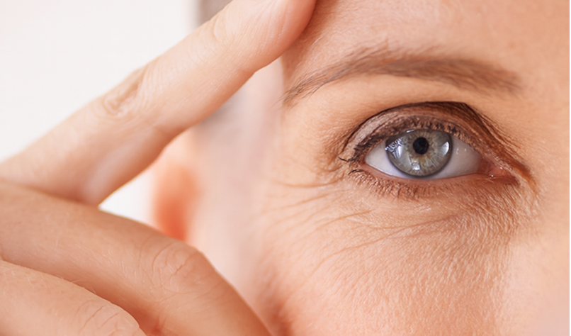 Imagem Blefaroplastia